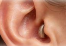 IIC - Invisible In Canal Hearing Aid