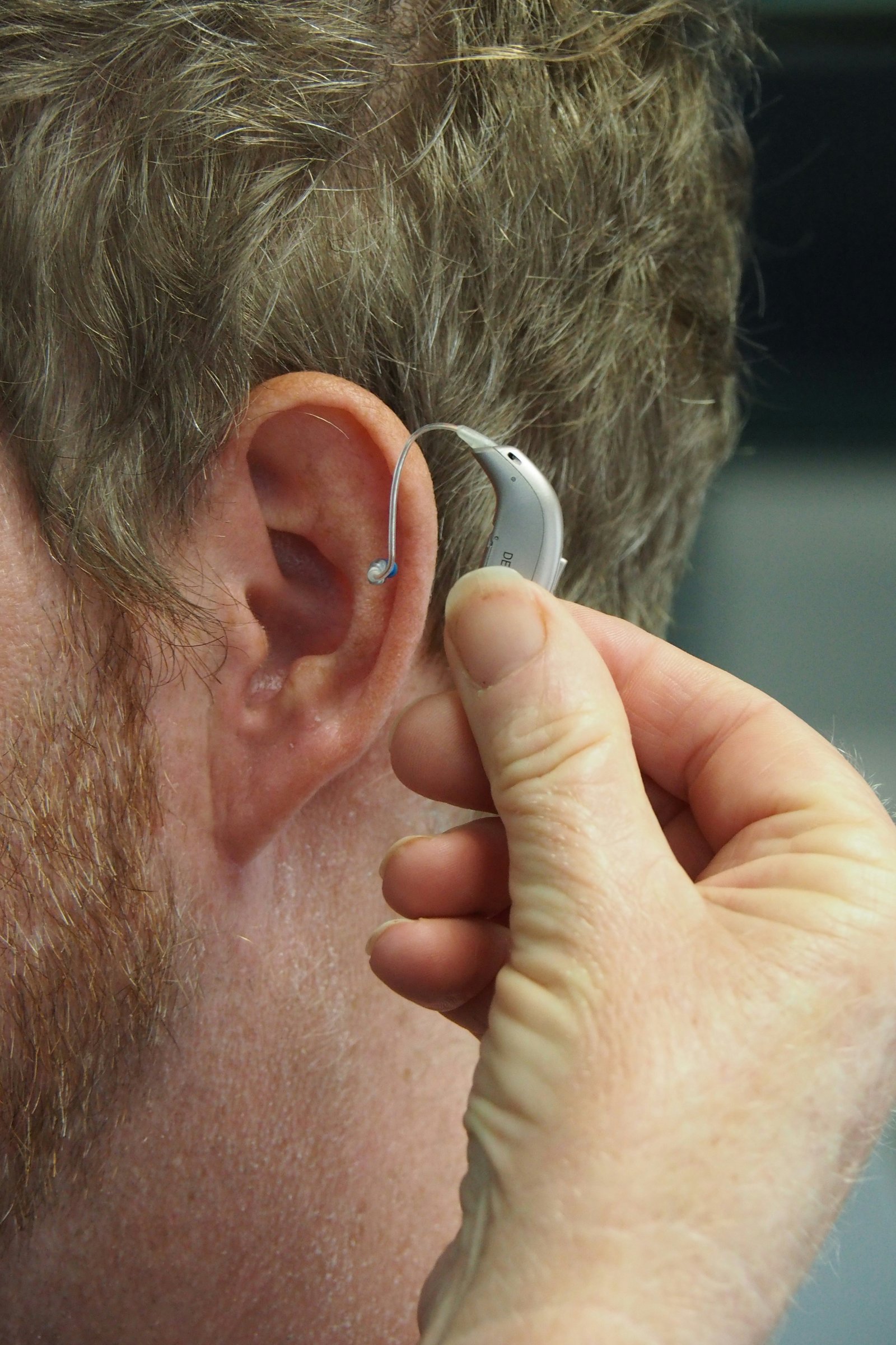 Custom Hearing Aid Trial and Fitting